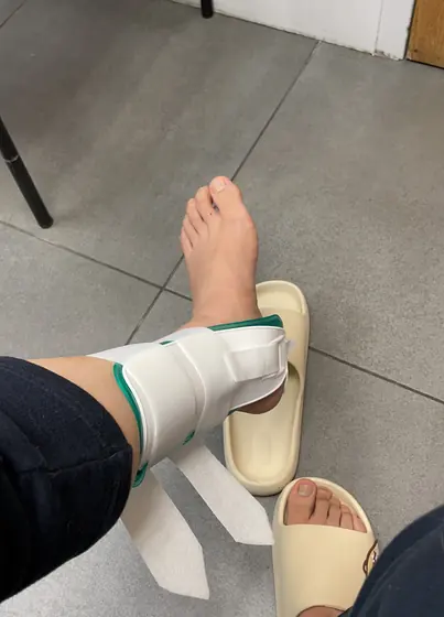A foot in a walking boot
