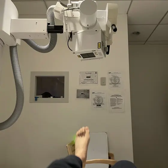 A foot X-ray at the clinic