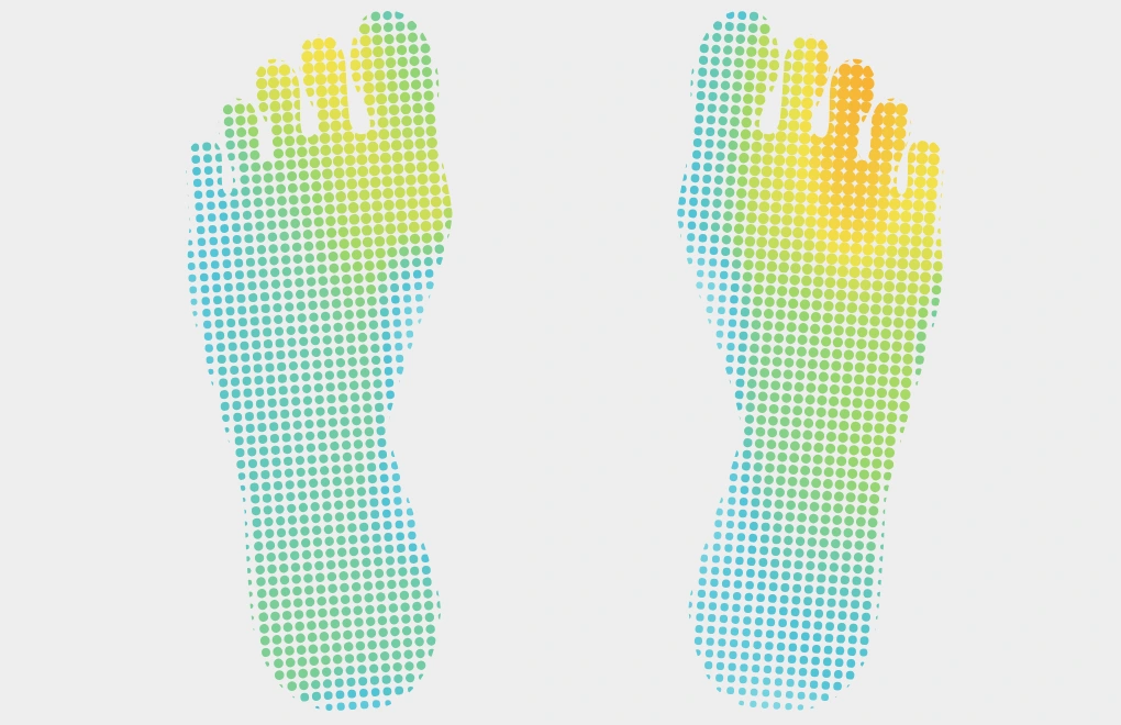Earlier pressure distribution. Forefoot share: left 33%, right 35%.